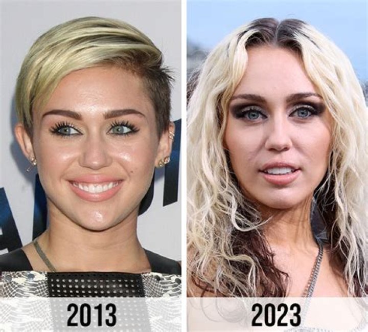[PICS] Miley Cyrus Weight Loss — Down 30 Pounds, She’s Stick Thin – Hollywood Life