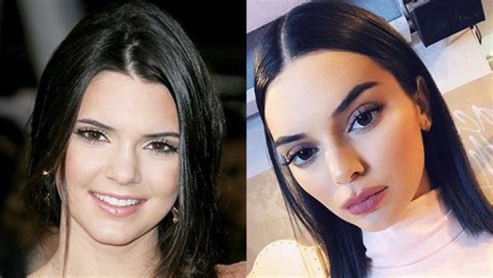 Pics Of Her Pout’s Evolution – Hollywood Life