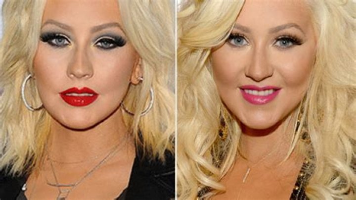 Plastic Surgery On Face? — See Before & After Pics – Hollywood Life