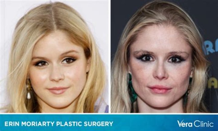 Plastic Surgery Rumors Are Completely False – Hollywood Life