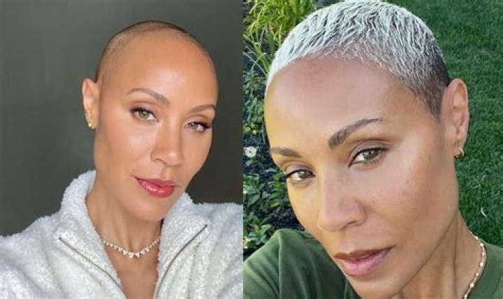Ricky Lake Shows Short Hair Transformation Amid Alopecia Battle – Hollywood Life