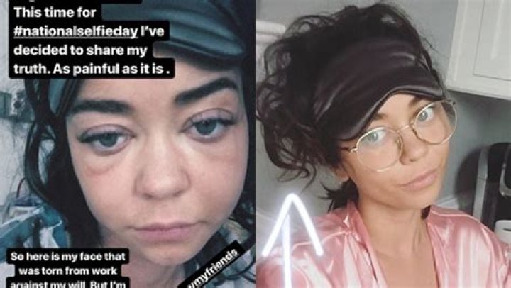 Sarah Hyland’s Swollen Face Smoothed Out By Nurse Post-Hospitalization – Hollywood Life