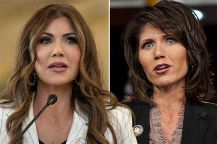 See Her Before & After Photos – Hollywood Life