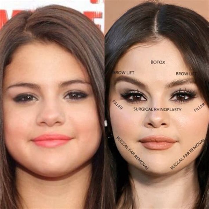 Selena Gomez Was Really ‘Messed Up’ By Body Shamers Criticizing Her Weight Gain After Lupus