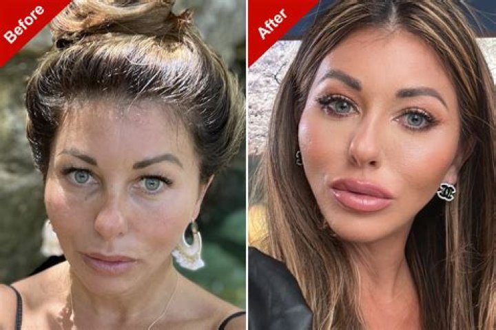 Sharon Osbourne Opens Up About Botched Facelift: ‘It Was Wicked’