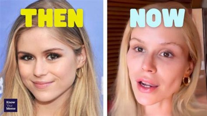 She Before & After Photos – Hollywood Life