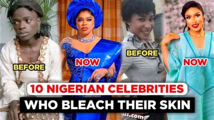 She ‘Bleached Her Skin’ – Hollywood Life