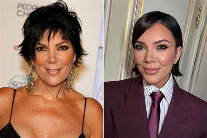 Shows Off Recent Surgery – Hollywood Life