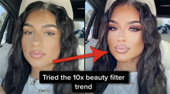 Snapchat Filters Inspiring Plastic Surgery — Would You Spend $2,000 To Look Perfect?
