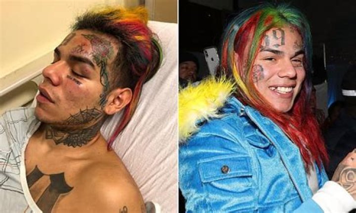 Tekashi69 Left Hospitalized After Getting Pistol Whipped, Kidnapped & Robbed