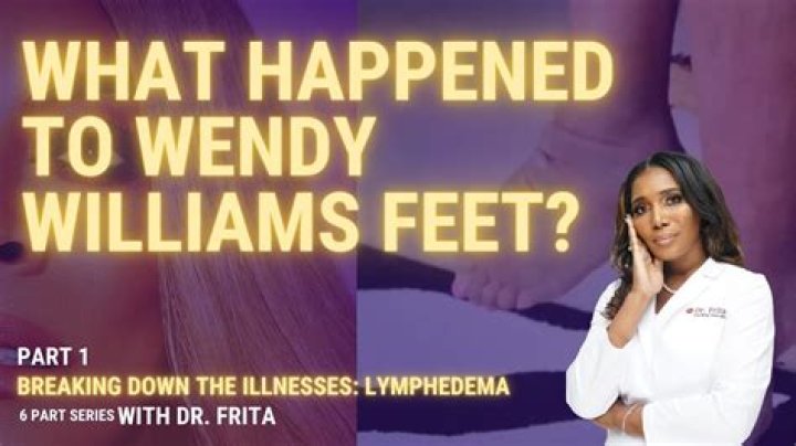 Wendy Williams Shows Swollen Feet From Lymphedema – Hollywood Life