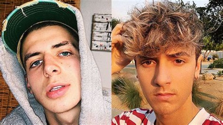 Zach Shares Photo Of Bruised Face – Hollywood Life